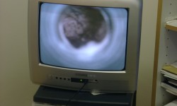 Endoscopy and Bronchoscopy